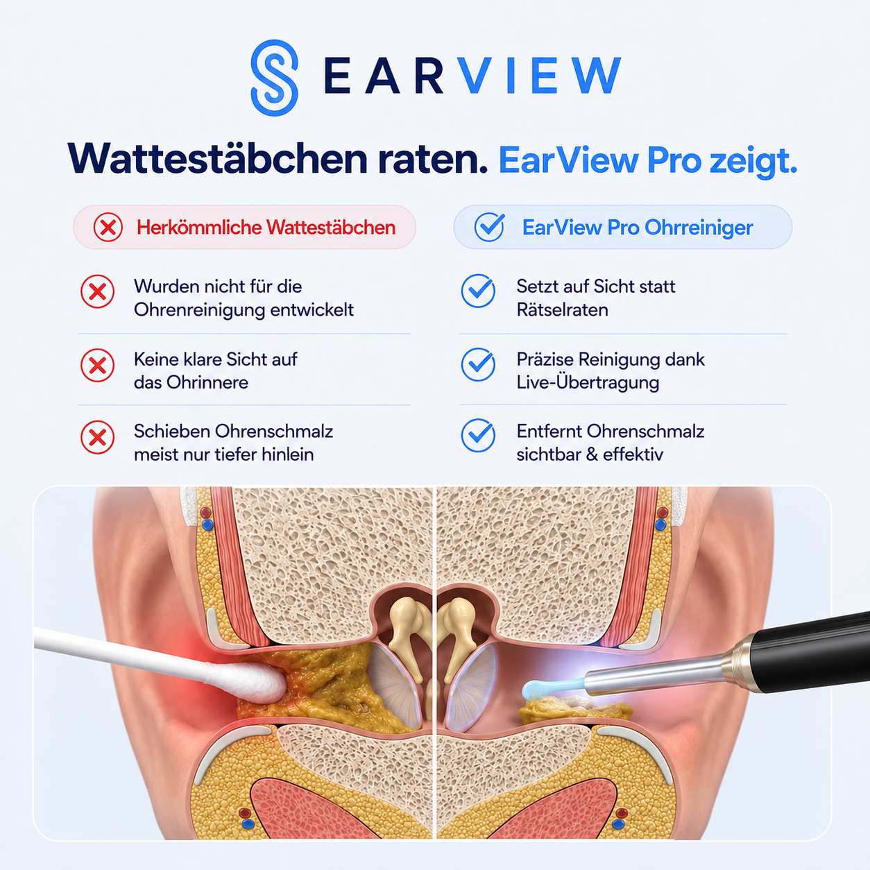 EarView® Pro